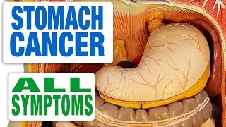 Stomach Cancer  All Symptoms [upl. by Virg]