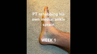 Physical Therapist rehabbing his own deltoid ligament sprain  Week 1 anklerehab anklesprain [upl. by Elocel]