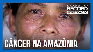 Repórter Record Investigação aborda a questão do câncer nas mulheres da Amazônia nesta segunda 5 [upl. by Zeke]