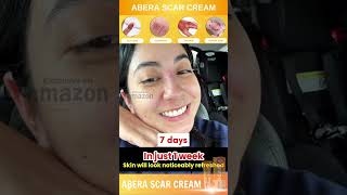 Effective Skin Repair with Abera Cream [upl. by Gilead640]