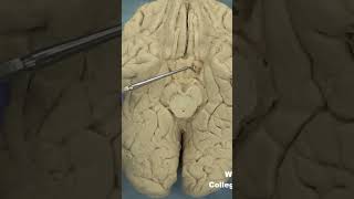 Parahippocampal gyrus uncusanatomyneuroanatomy cerebrumbraincortextemporallobelimbicsystem [upl. by Munro]