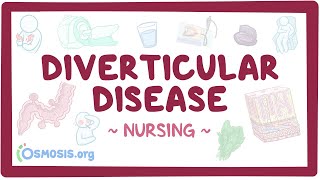 Diverticular disease Clinical Nursing Care [upl. by Afital]