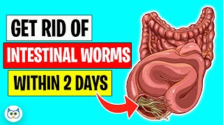 Use These Natural Methods To Get Rid of Intestinal Worms Within Two Days [upl. by Idisahc]