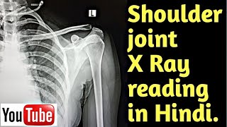 How to read shoulder joint xray । Anatomy of shoulder । Uday Xray [upl. by Ecirtaed508]