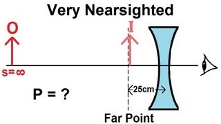 Physics  Optics Vision Correction 3 of 5 Very Nearsighted [upl. by Anastatius]