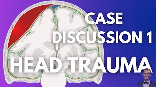 Case Discussion Neurosurgery  Head Trauma  Case 1 [upl. by Antoinetta51]