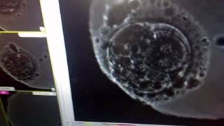 Time Lapse by Primo Vision Mitera IVF Athens [upl. by Sanger985]