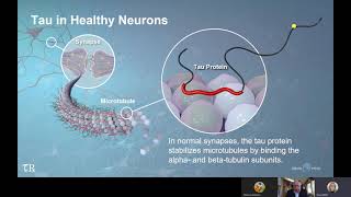 Targeting Tau in Alzheimers Disease [upl. by Godart763]