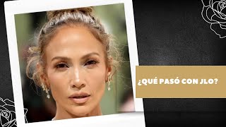 ¿QUÉ PASÓ CON JLO [upl. by Egduj]