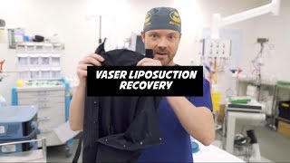 Vaser Liposuction Recovery [upl. by Assiron875]