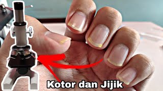 Kuku Panjang dan Kotor  Dirty Nail Under Microscope [upl. by Arebma]