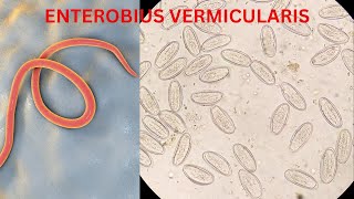 PINWORM biology educationalvideos informationalvideo worms subscribehealthylivingmicrobiology [upl. by Ariay]