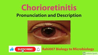 Chorioretinitis YoutubeShorts [upl. by Yralih]