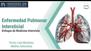 Enfermedad pulmonar intersticial Enfoque del internista [upl. by Presley206]