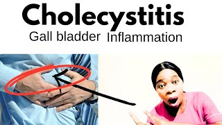 What to expect if your patient has cholecystitis and what to do after surgery [upl. by Ocana]