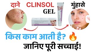 दाने और मुंहासे के लिए। Clinsol Gel review in hindi  clinsol benefitsside effects  clinsol gel [upl. by Rolfe]