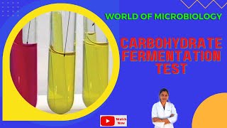 Carbohydrate Fermentation Test Tamil  Identification of Bacteria by Biochemical Test [upl. by Yrahcaz]