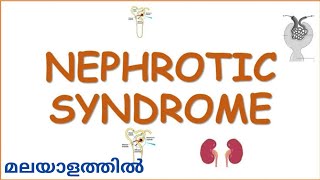 NEPHROTIC SYNDROME overview in Malayalam  Medical Surgical Nursing  Mr Nurse Manglish [upl. by Ahsekam405]