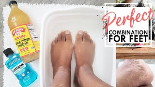 Listerine Foot Soak  Is It Effective  Listerine And Vinegar Foot Soak  Listerine Foot Bath [upl. by Elohc]