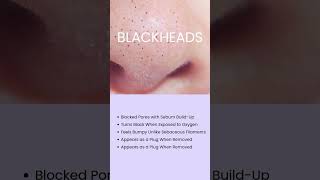 Tired of blackheads Youre not alone Heres the difference between blackheads ampsebaceous filaments [upl. by Telfer]