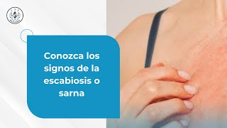 Conozca los signos de la escabiosis o sarna [upl. by Flori]