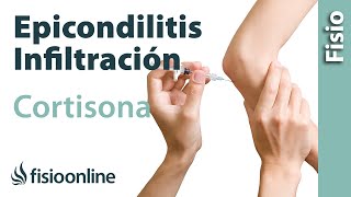 Epicondilitis o codo de tenista y las infiltraciones de cortisona o corticoides [upl. by Olonam]