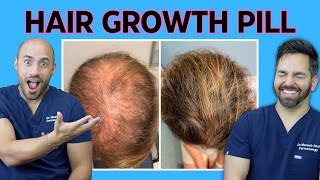 quotNEWquot Cure for Hair loss  Doctorly Reviews ORAL MINOXIDIL [upl. by Lamiv]