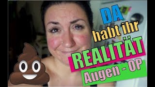 Familien Vlog 💩 für mehr Realität auf Youtube 😓 ich muss am Auge operiert werden 🎂Heikos Birthday [upl. by Yanahc]