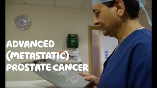 About Advanced Metastatic Prostate Cancer [upl. by Derwood]