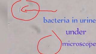 urine examination of bacteriaurine practical examinationUrine REmicroscopic examination of Urine [upl. by Jacki]