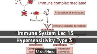 Immune complex mediated type 3 hypersensitivityUrduHindi [upl. by Lemuel]