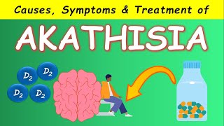 Akathisia by Antipsychotics  Causes Symptoms and Treatments [upl. by Novy]