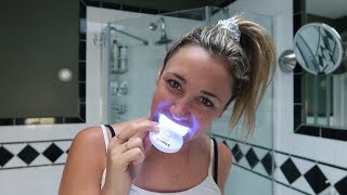 Do athome teeth whitening kits really work  Glam Lab [upl. by Oballa]