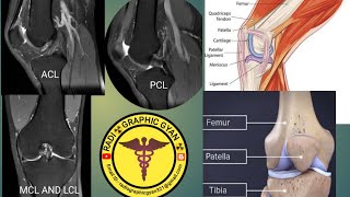 MSK knee joint MRI 3T Knee joint msk mri knee [upl. by Irish]