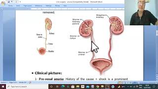 Urosurgery in Arabic 17 Anuria  part 1   by Dr Wahdan [upl. by Ytirev]