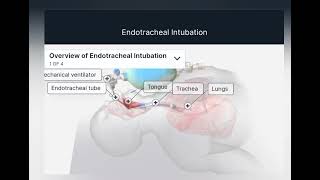 Endotracheal intubation hayatayoz [upl. by Ardnola]