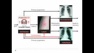 Bio303 2012 Public Health and Emerging Infections Tuberculosis [upl. by Sillad]