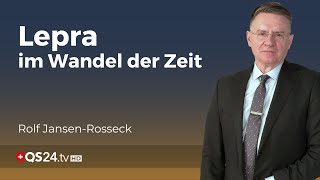 Lepra Die älteste Infektionskrankheit und ihre heutige Relevanz  Unter der Lupe  QS24 [upl. by Airehs]