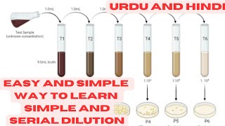 Dilutions and serial dilutions practically explained MicroPharmaTube MicrobiologyInsider [upl. by Nospmas902]