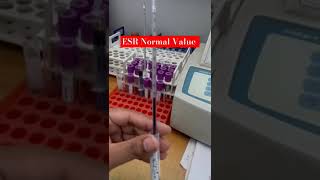 ESR Erythrocyte Sedimentation Rate🩸 Infection blood  ESR infection paramedical [upl. by Almund]