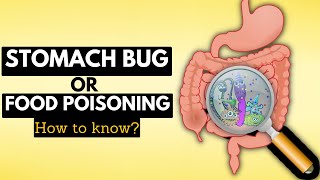 How to Tell if You Have a Stomach Bug or Food Poisoning A Complete Guide [upl. by Novel435]