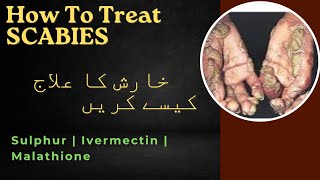 Drugs Use For Scabies Treatment  Ivermectin  Use Of Sulphur amp Permethrin in Scabies  Malathione [upl. by Zola]