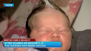 Bebê que nasceu de cabelo branco faz sucesso nas redes sociais [upl. by Esydnac906]