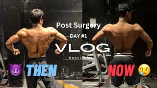 post surgery ￼Day 1  Back Workout [upl. by Siravaj751]