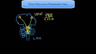 Bulbar Palsy versus Pseudobulbar Palsy [upl. by Alaj]