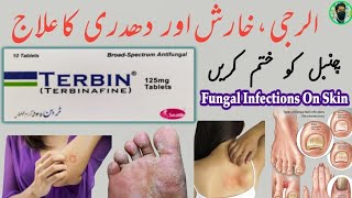 terbin ds tablet uses in urdu  Hindi  Terbinafine tablet Ky fayde  how to use terbin 125mg tablet [upl. by Arahc300]