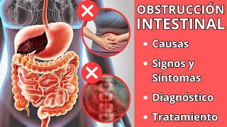 OBSTRUCCIÓN INTESTINAL  Causas signos y síntomas diagnóstico y tratamiento [upl. by Dnomse]