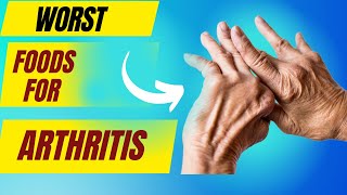 Foods to avoid with arthritis Anti inflammatory diet for arthritis  Arthritis causes food [upl. by Nonnelg]