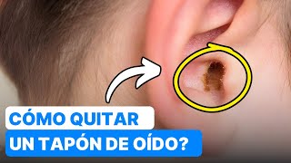 ¿Cómo Quitar un Tapón de Cera aceite de oliva velas 😮 [upl. by Kneeland]