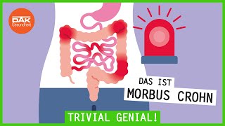 Das ist Morbus Crohn  trivialgenial  DAKGesundheit [upl. by Osmo]